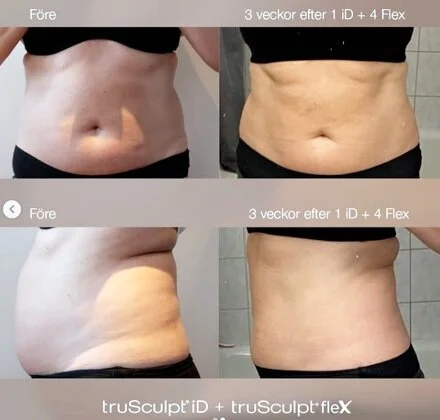 Basic Fit Trusculpt iD and flex.png