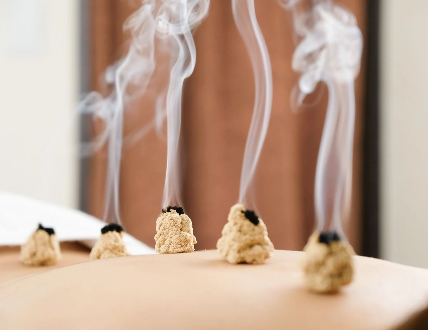 Acupuncture for peace of mind, harmony and vibrant health