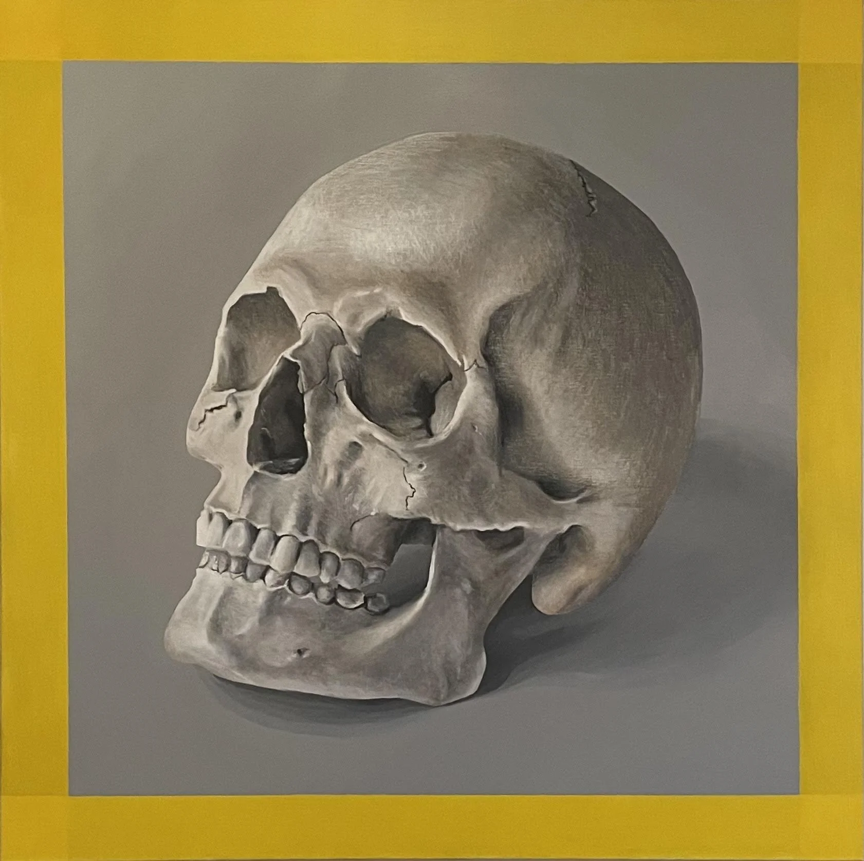 A human skull with cracks, positioned against a gray background, framed by a yellow border.