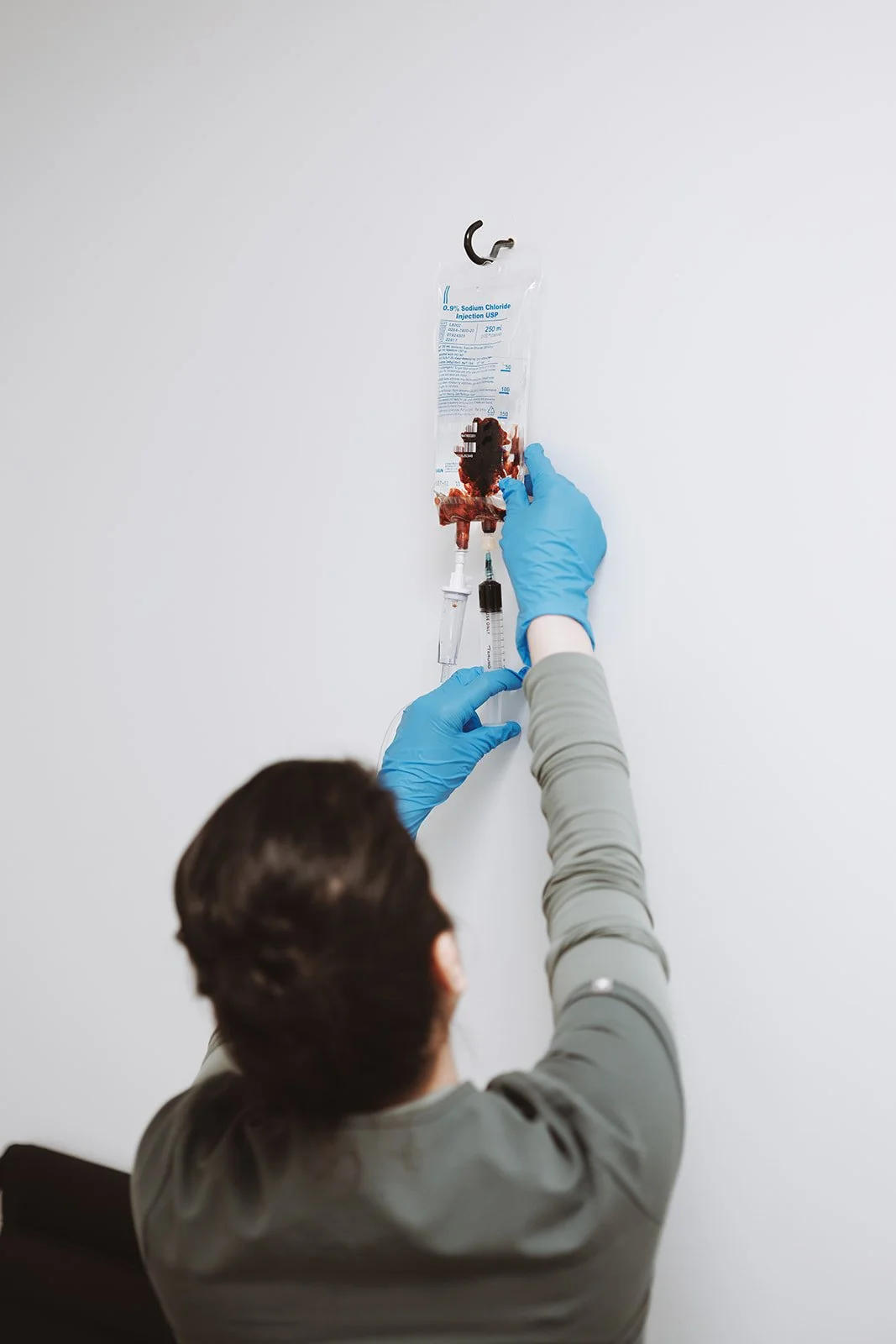 Iron infusion anemia Burnaby