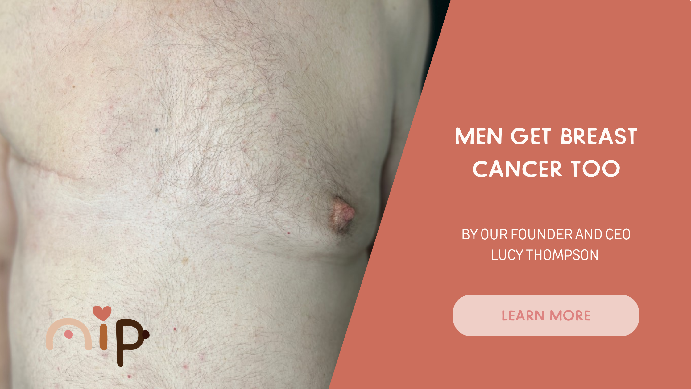 Men Get Breast Cancer Too