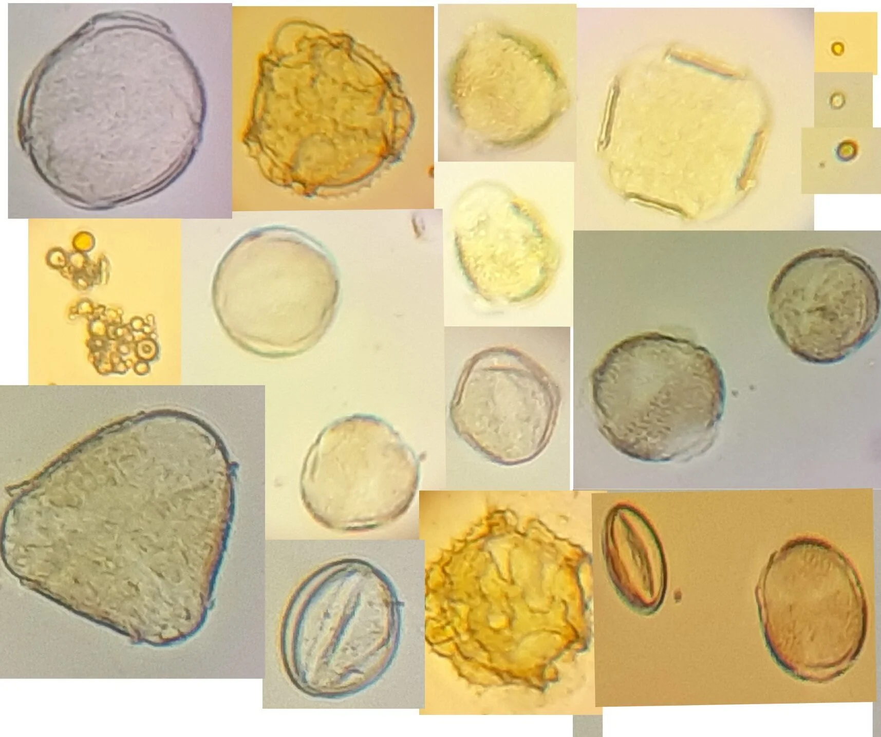 These are some amazing shapes of the pollen granules in our honey