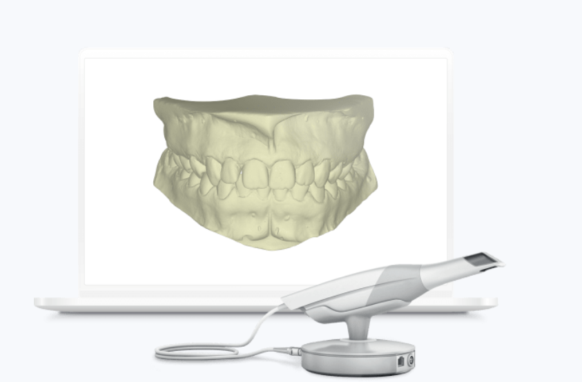 A digital 3D model of human teeth and jaw on a computer screen, connected to a dental scanner device.