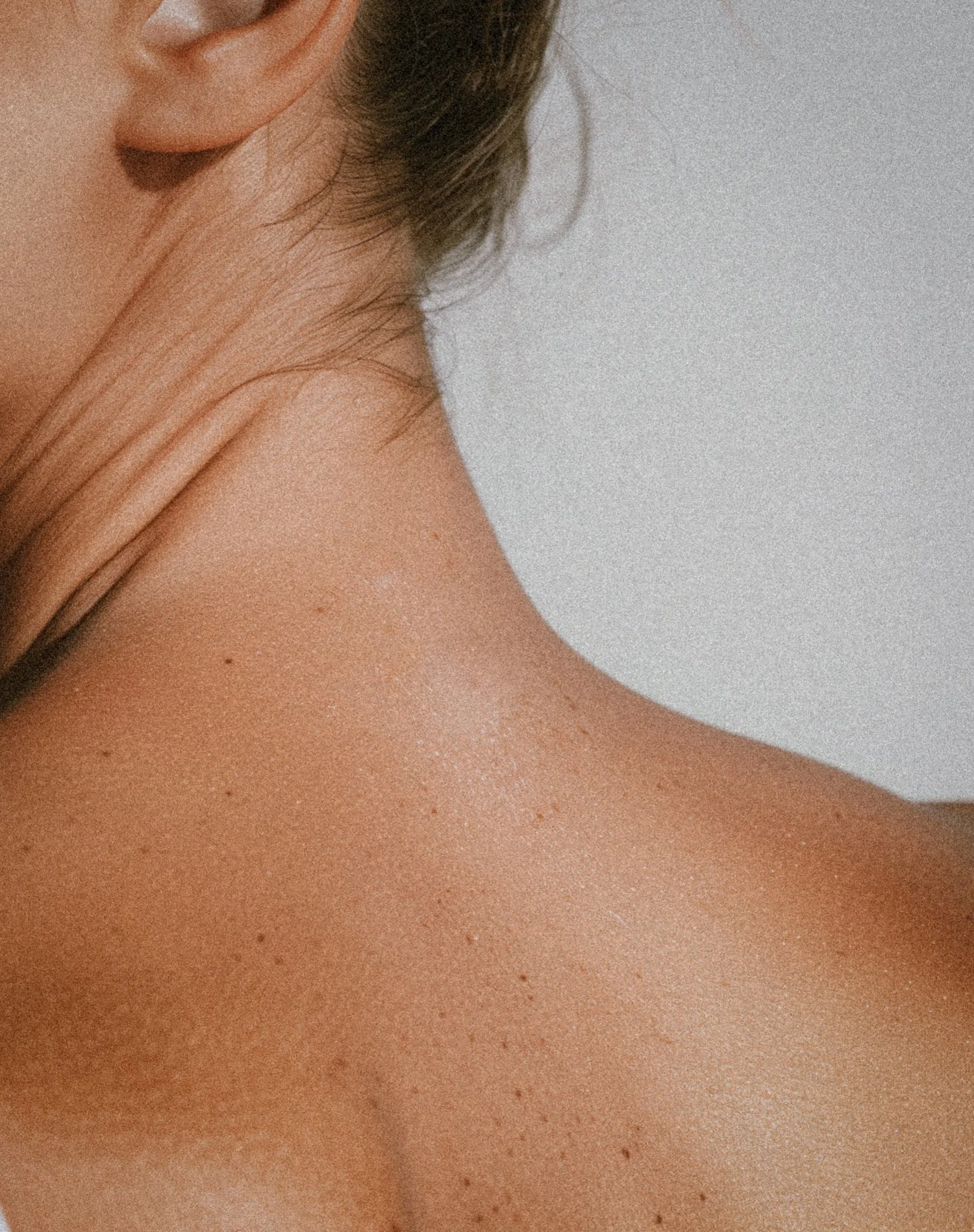 Close-up of a person's shoulder and neck with visible skin texture and some freckles, part of the person's face and hair also visible.