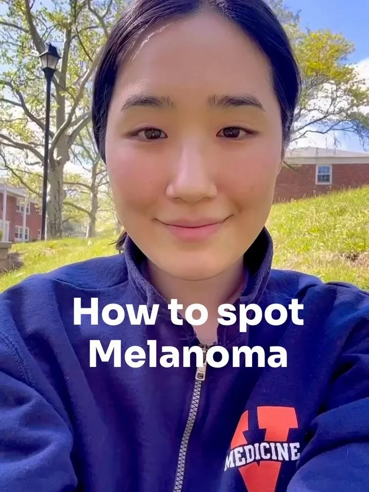Knowing the ABCDEs of melanoma can quite literally save your life. Here is exactly what you should be looking for when checking your spots. #MelanomaAwareness #CheckYourMoles #Dermatology #SkincareTips #SunSafety