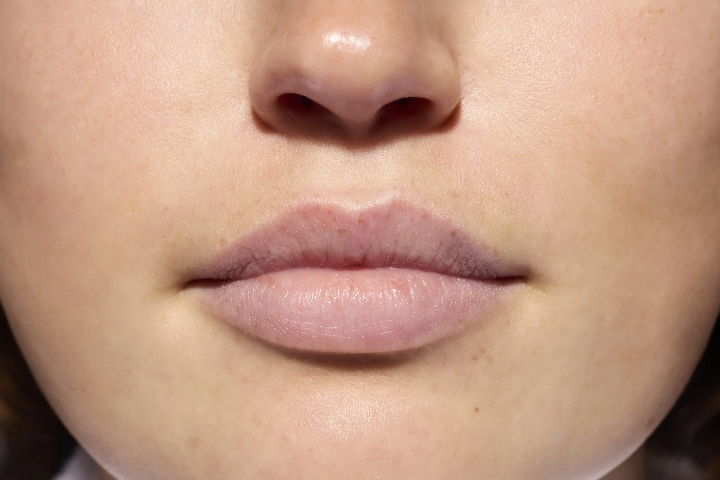 EMD_UVDailyPeptideLipBalm_Ella_After.jpg