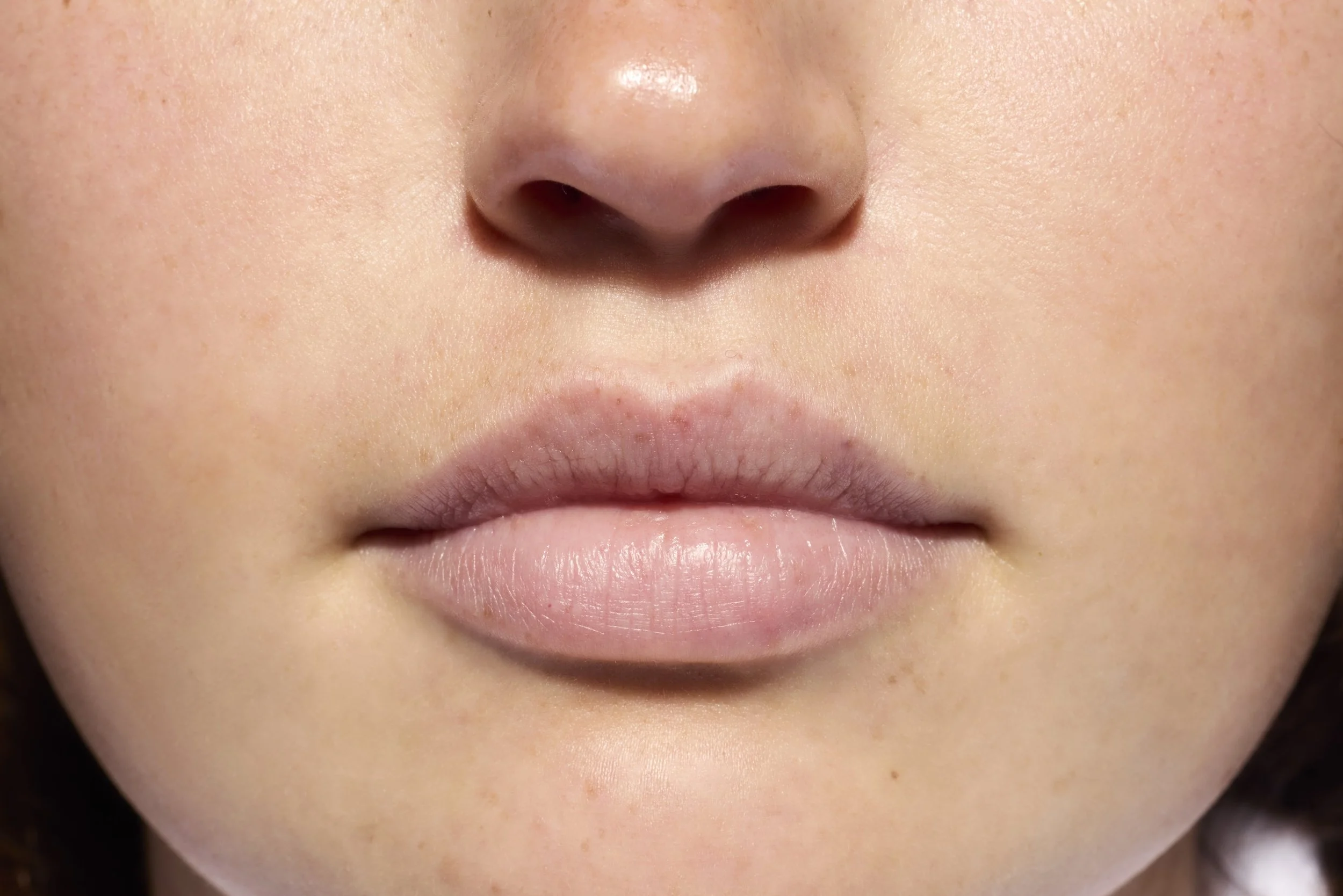 EMD_UVDailyPeptideLipBalm_Ella_Before.jpg