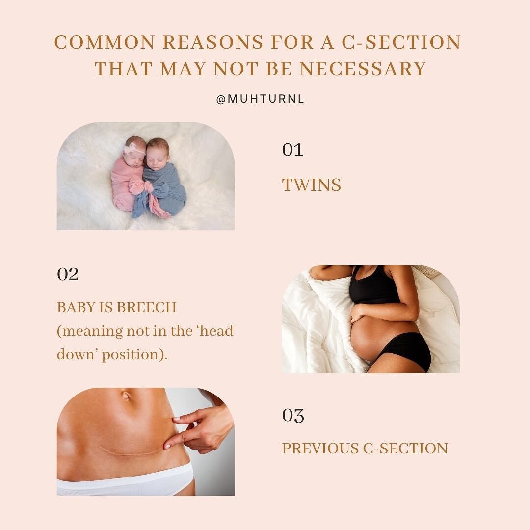 Did you know that even in certain circumstances a c-section is not always necessary? 

Yes, even if you are having:

1. TWINS

2. A BREECH BABY

3. Or have had a previous C-SECTION

Cesarean sections can help save lives, but may not always have to be
