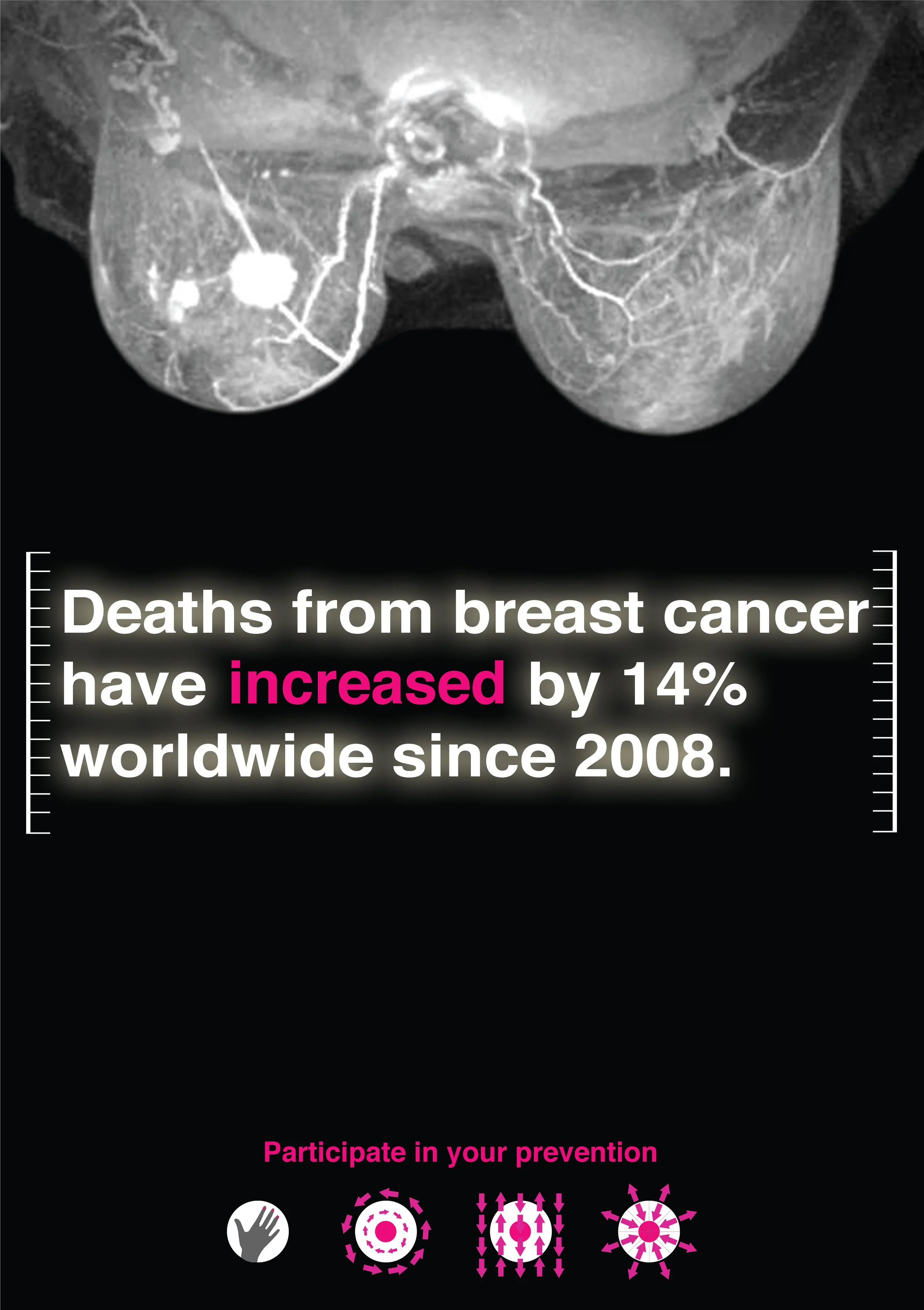 breastcancerpreventionposterRGB-01.jpg
