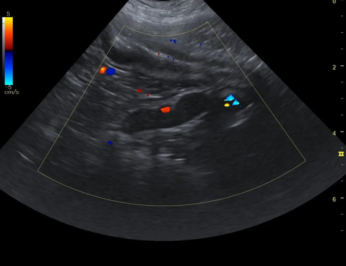 Ultrasound image from exam by Focused Ultraousand Resources