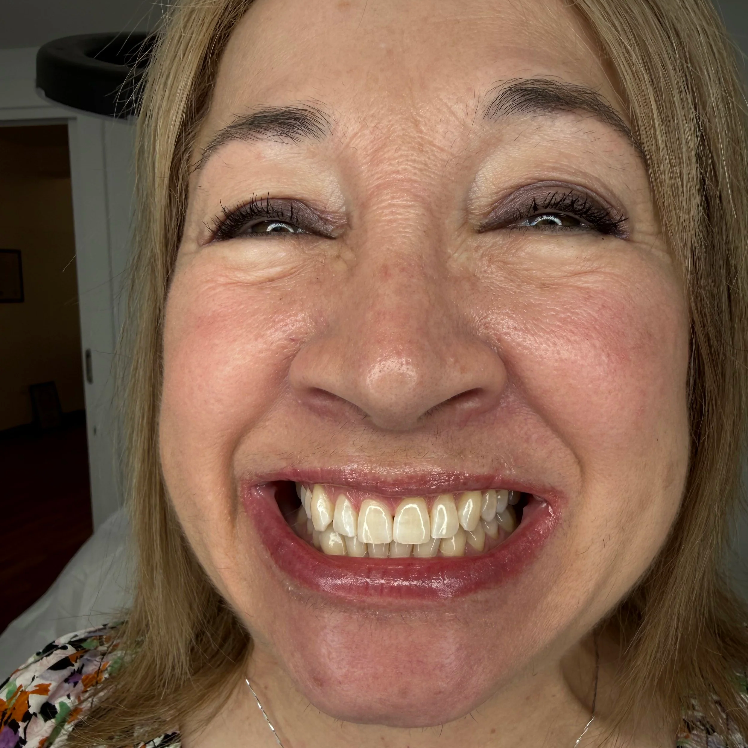 Client under LED light during a teeth whitening session