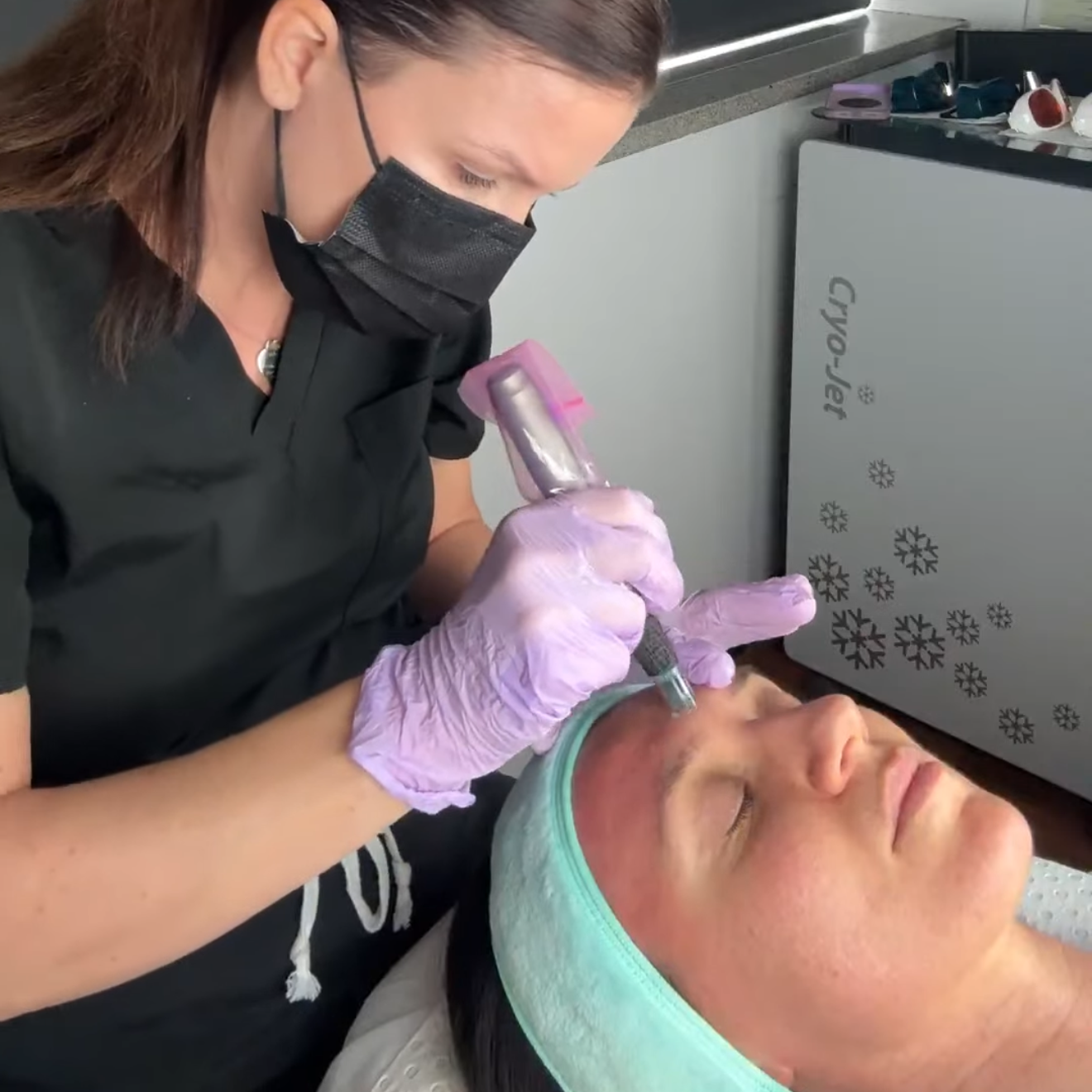 Microneedling treatment in progress on a client's face
