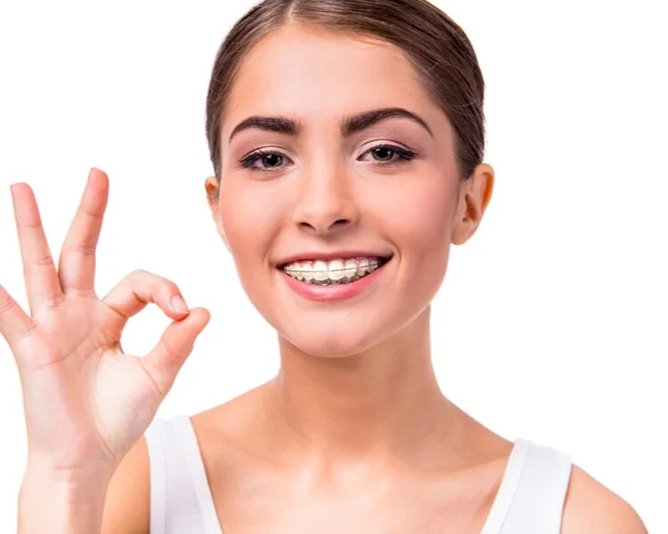 advantages-of-clear-braces-1200x600.png