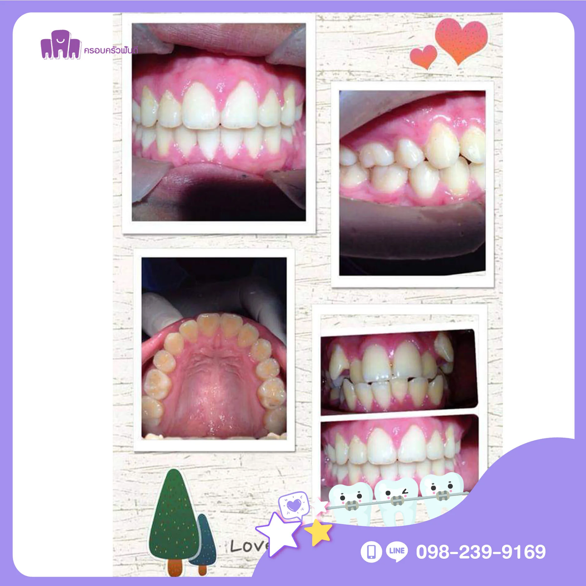Framefundee-c-03-bg.jpg