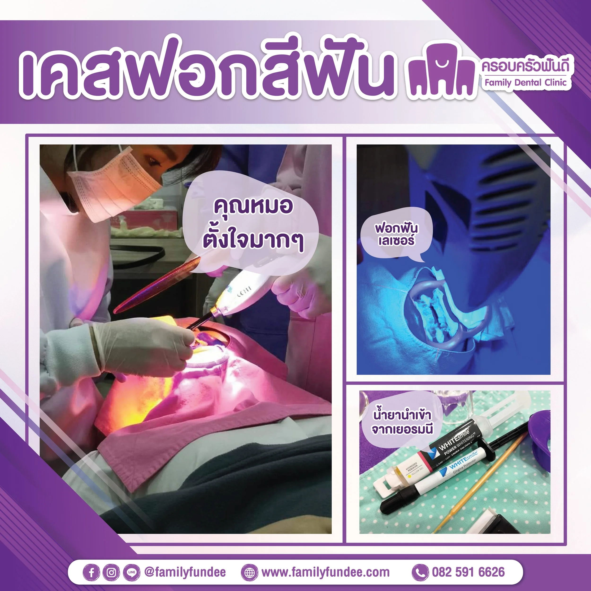 ใครอยากฟันขาว ระยอง นี้เลยฟอกสีฟันด้วยเลเซอร์ ขอบคุณรีวิวจากคนไข้ คนสวยด้วยน้ามาสร้างร้อยยิ้มที่มั่นใจกับครอบครัวฟันดี💜