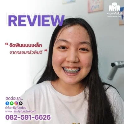 Reviewจัดฟันเหล็กD1-04-400x400-min.jpeg