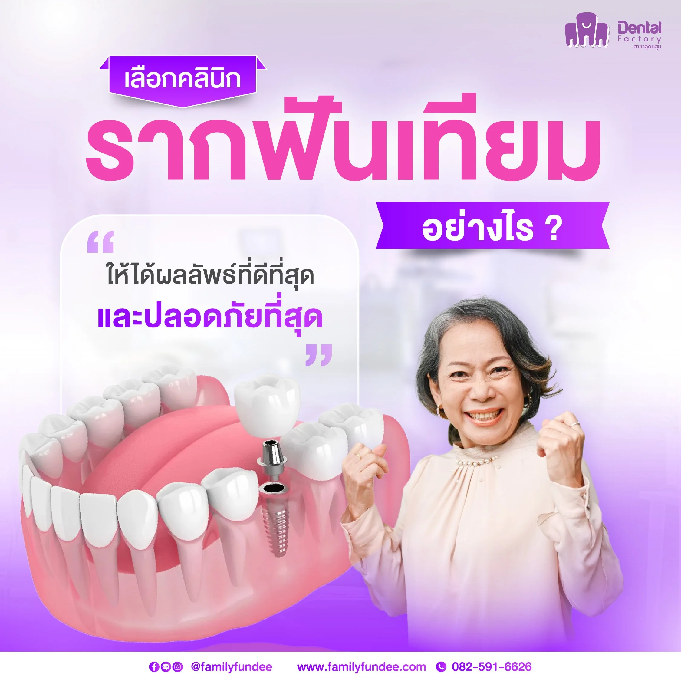 เลือก “ คลินิกรากฟันเทียม ” อย่างไร ให้ได้ผลลัพธ์ดีและปลอดภัย&nbsp;(ครบถ้วนทุกข้อควรรู้ก่อนตัดสินใจ)
