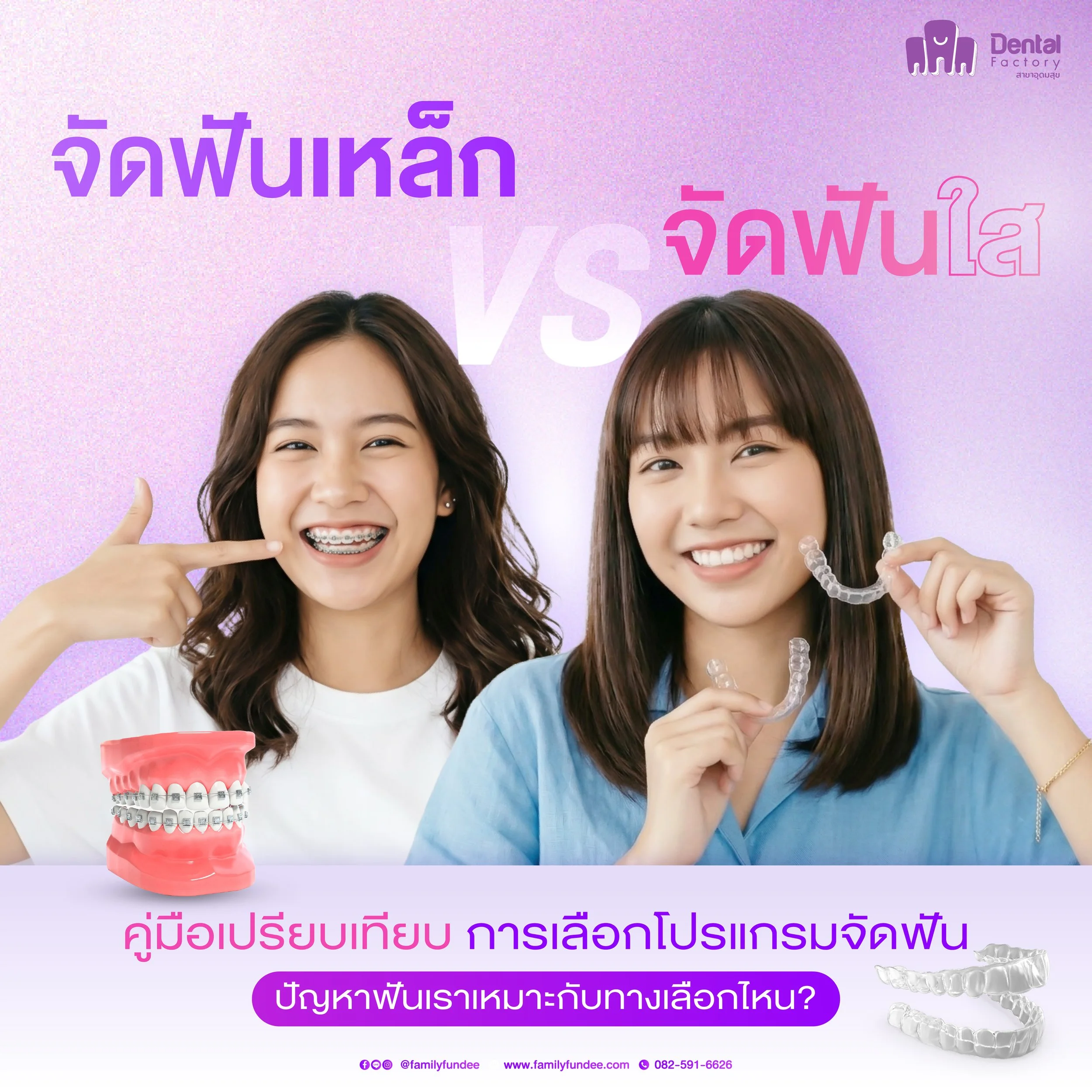 จัดฟันใส อุดมสุข