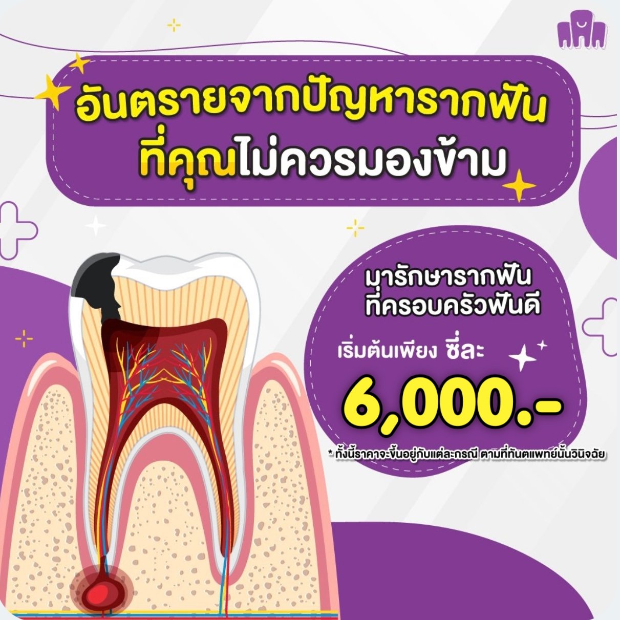 รักษาราก.jpg