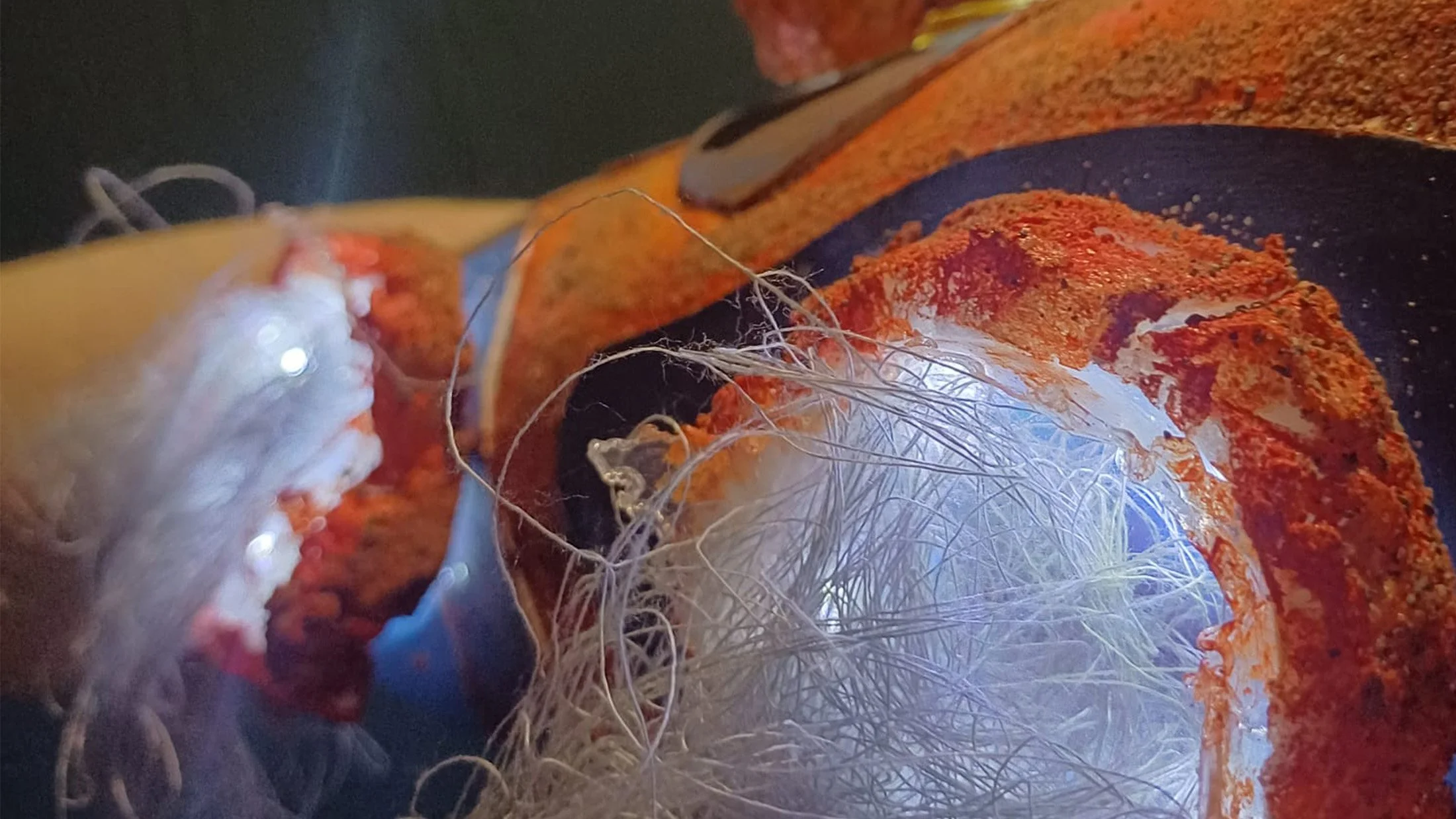 Development of Acid spheres on the ‘ATTACK’ model.