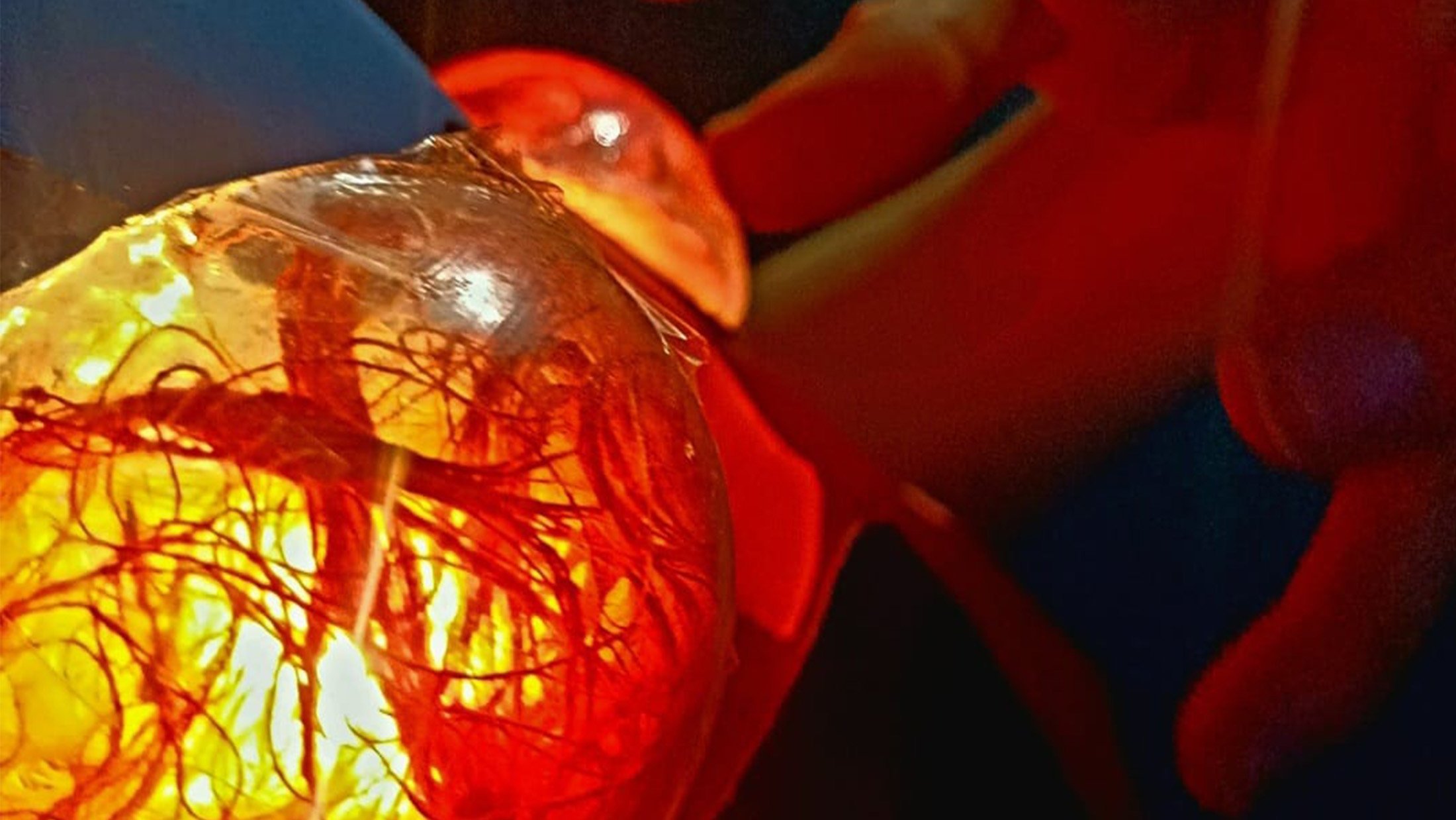 Development of acid spheres on the ‘DETECTION’ model.