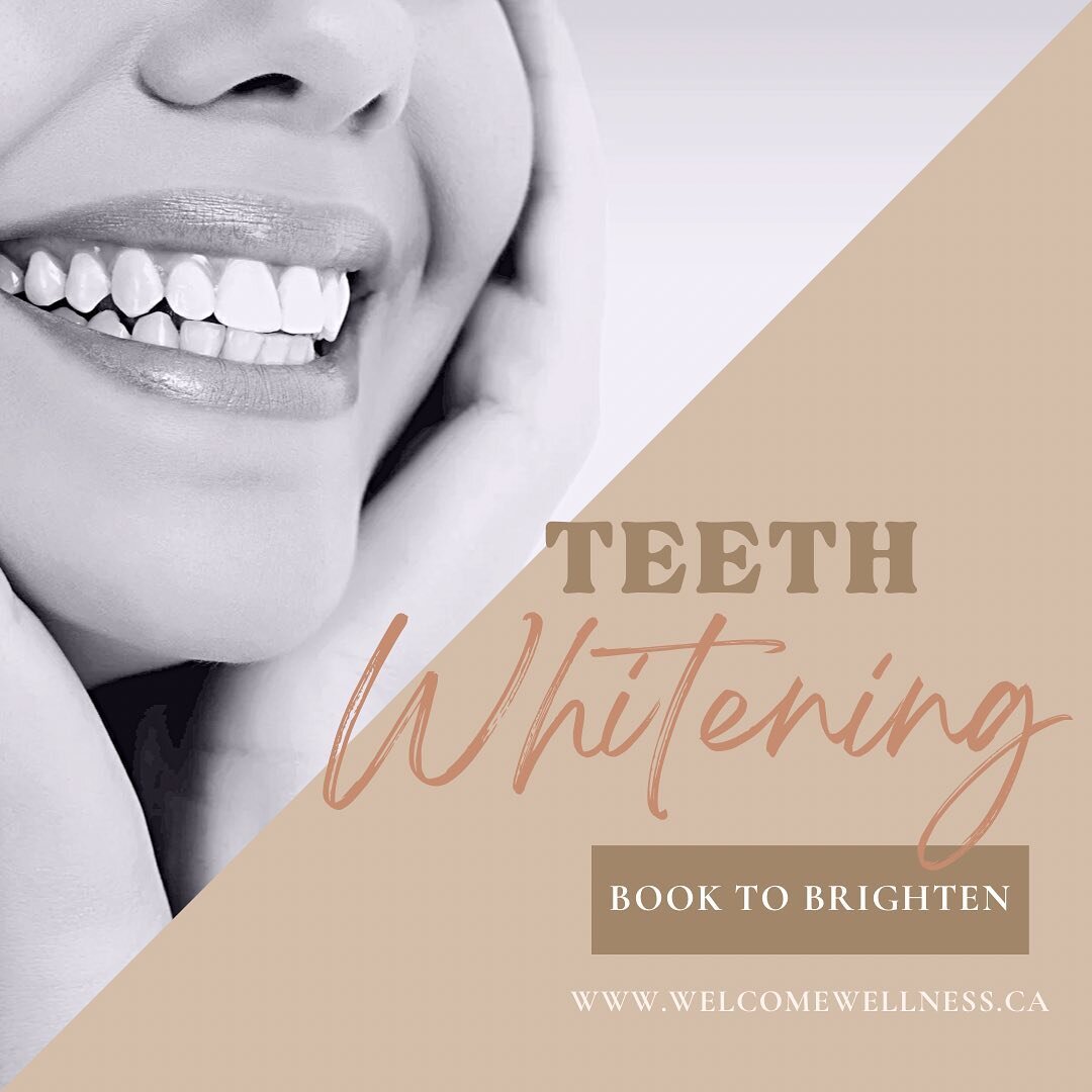 Brighten your smile this Spring with a teeth whitening session 🦷💫.

If you&rsquo;ve whitened with us in the past, you can now book a mini session (30 minutes) to boost your smile.

Have a question? Send a DM 🪥