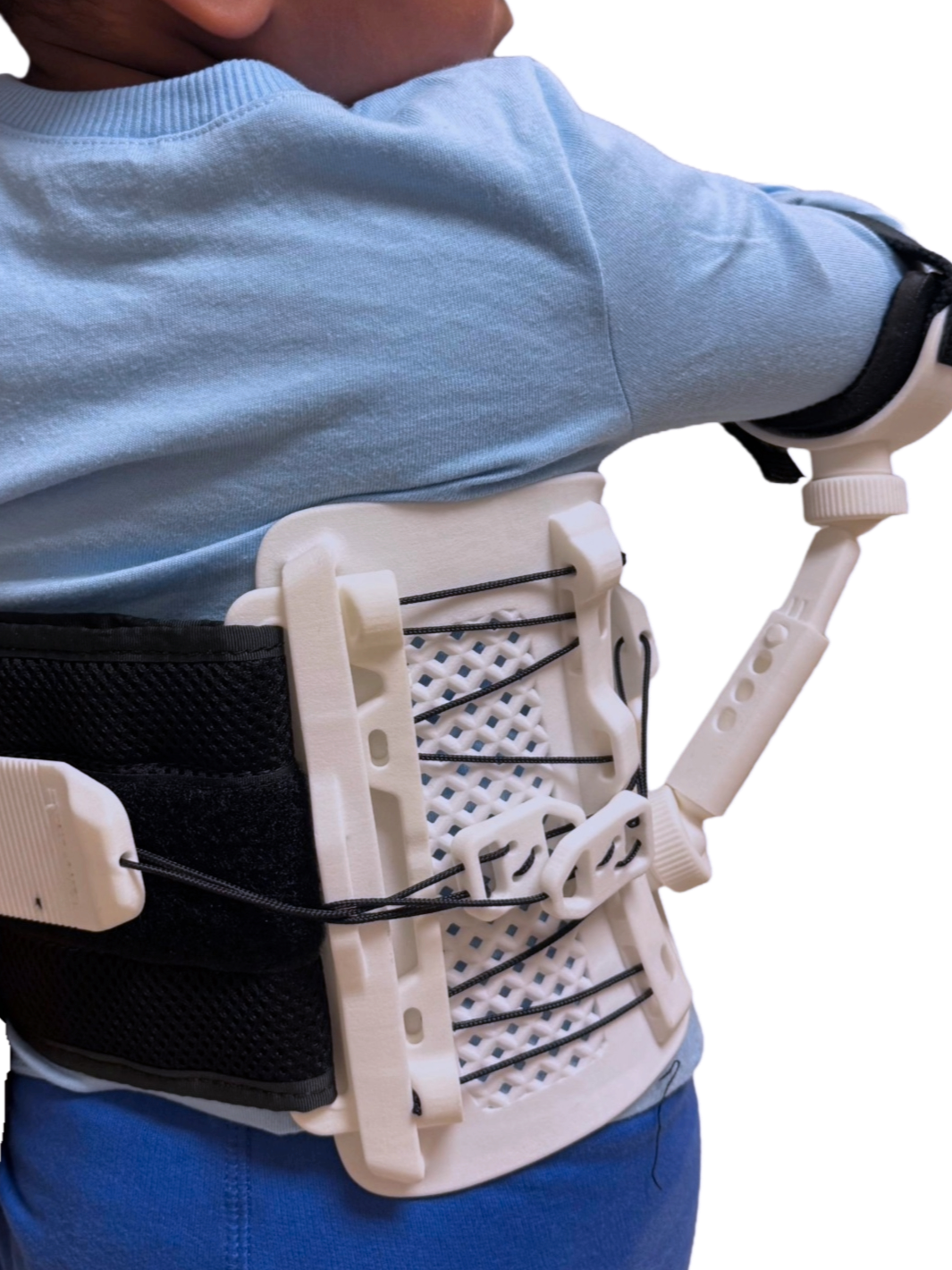 mign pediatric Brachial Plexus brace