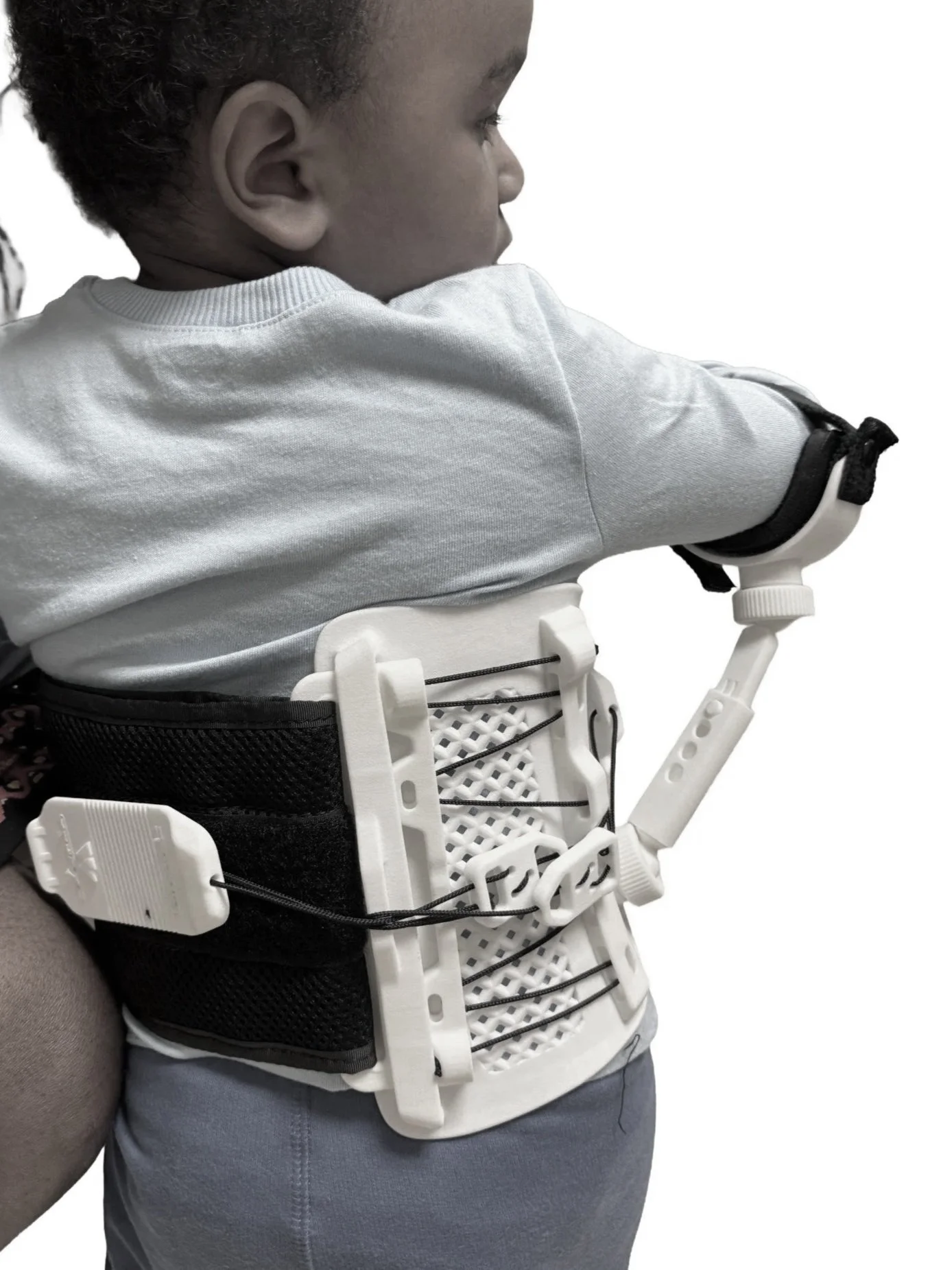 A child in a white shirt with a medical or orthopedic brace on their torso and arm, photographed against a white background.