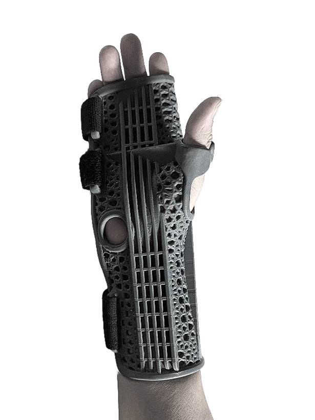 A hand wearing a black 3D-printed prosthetic finger with a textured design and straps.