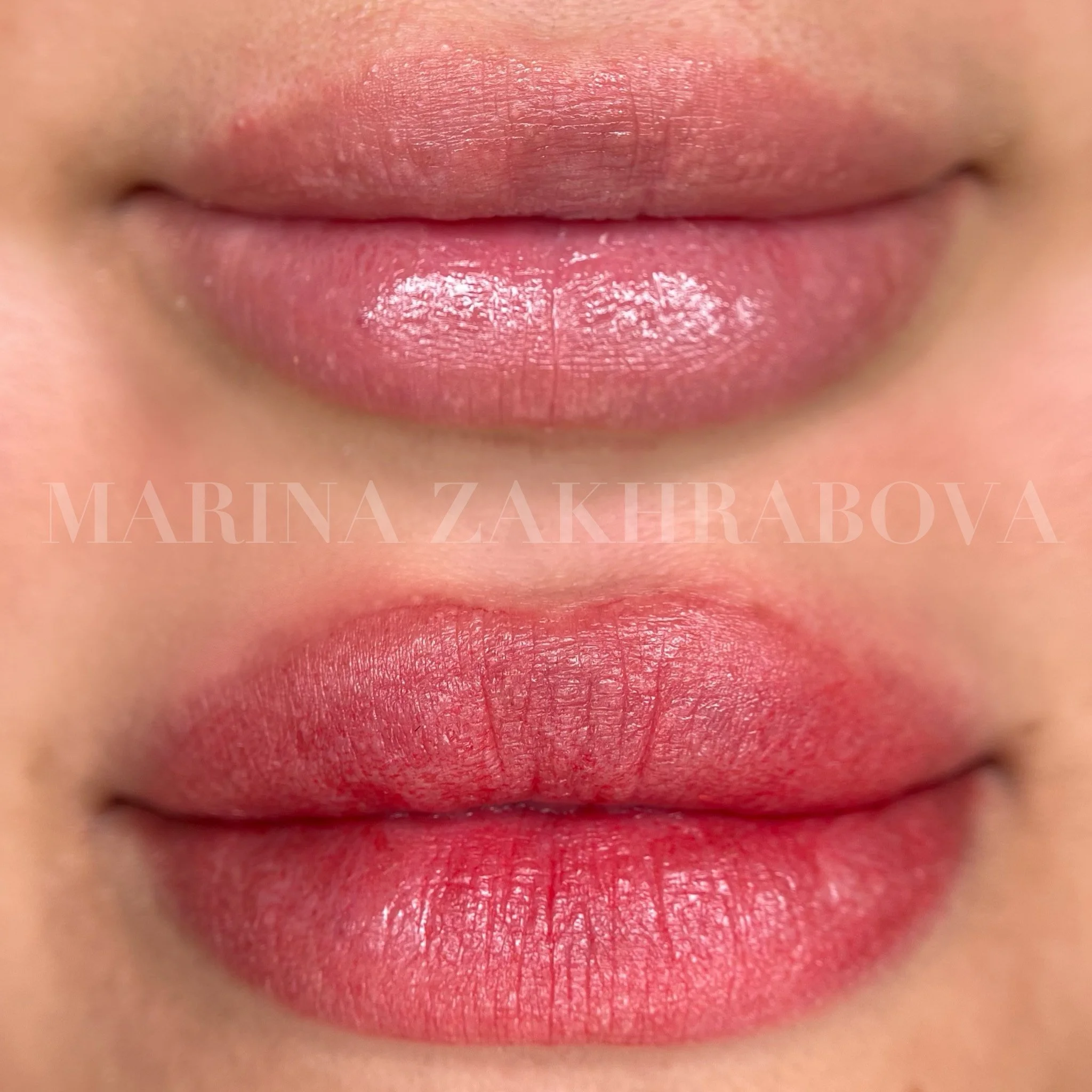 before and after lip blush