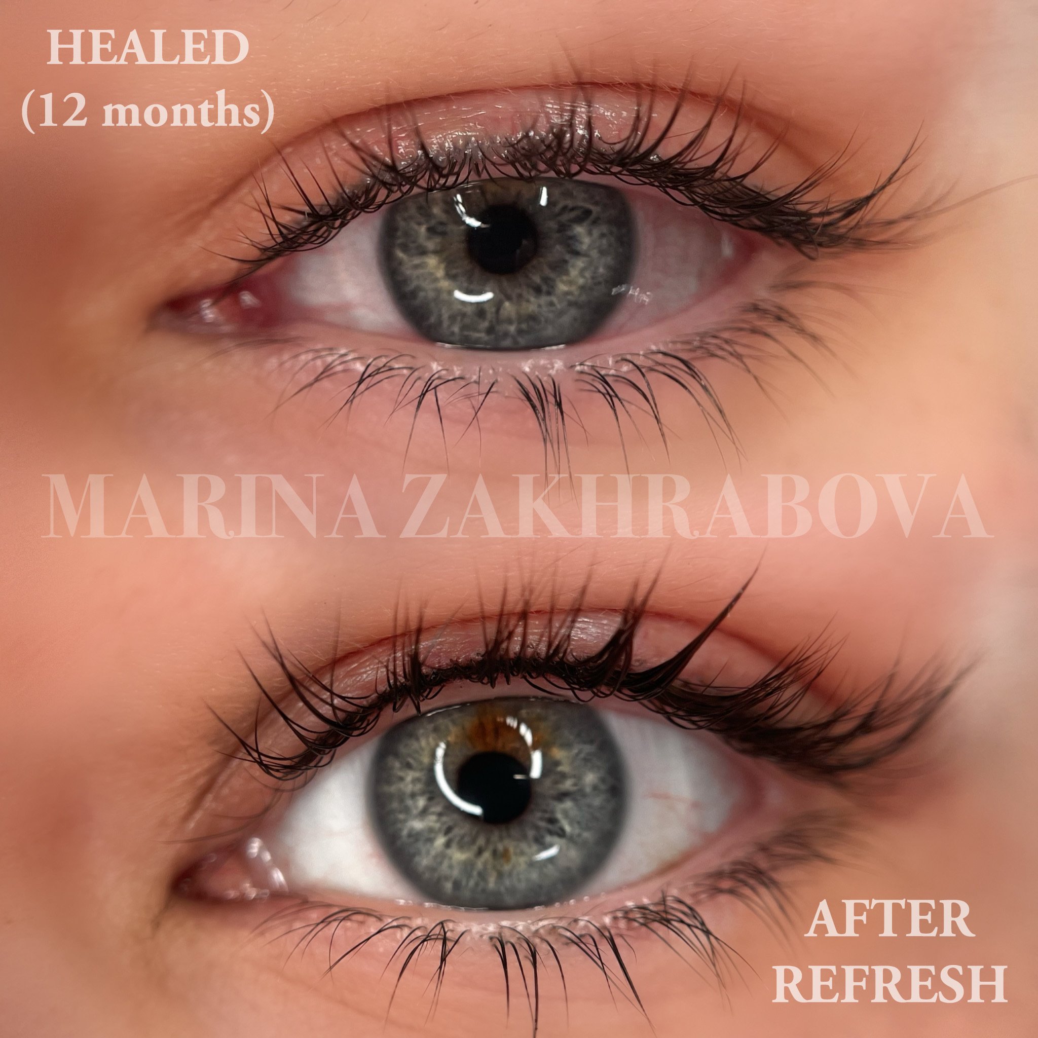 HEALED and immediately after lash liner REFRESH