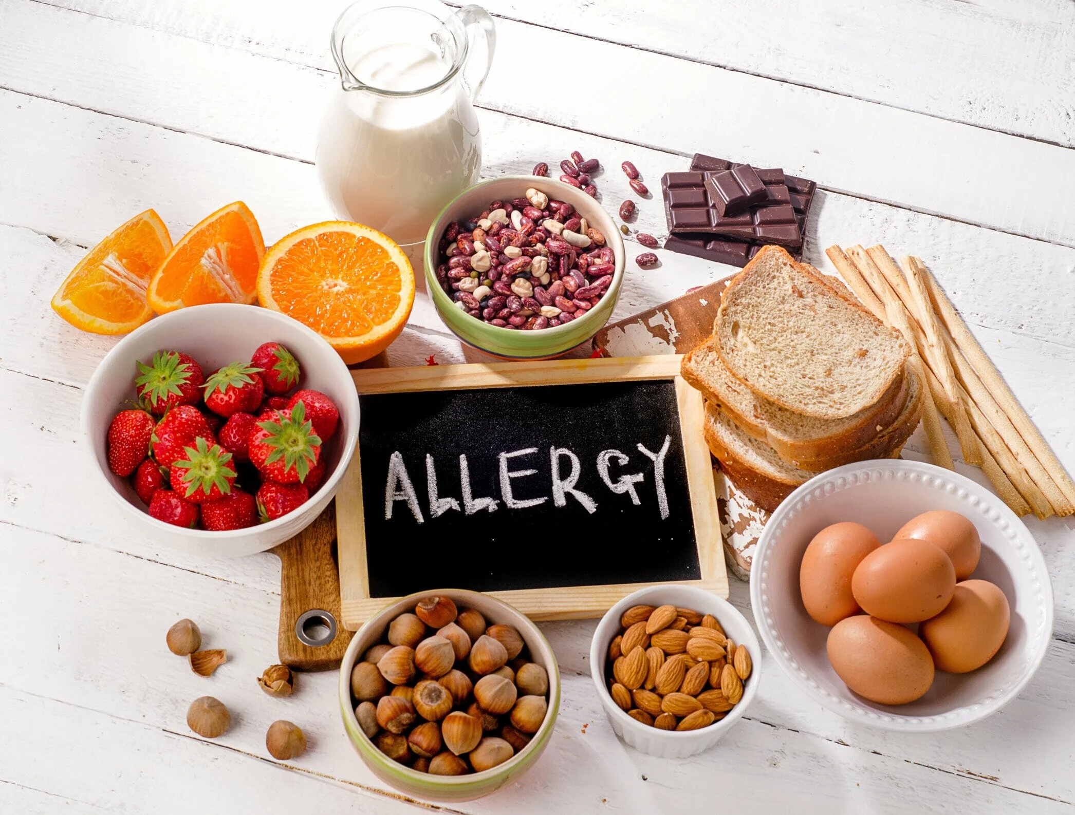 How social media is helping our health: Influencers address food allergies and intolerances 