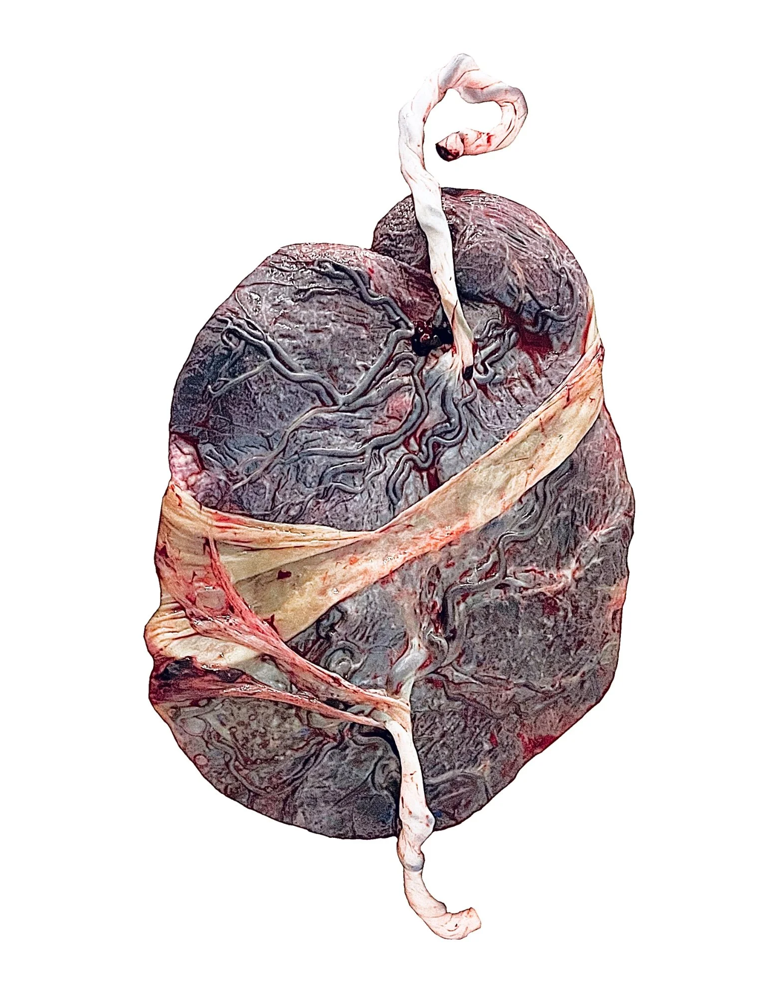 Placenta Print - Jac Van Horn.jpg