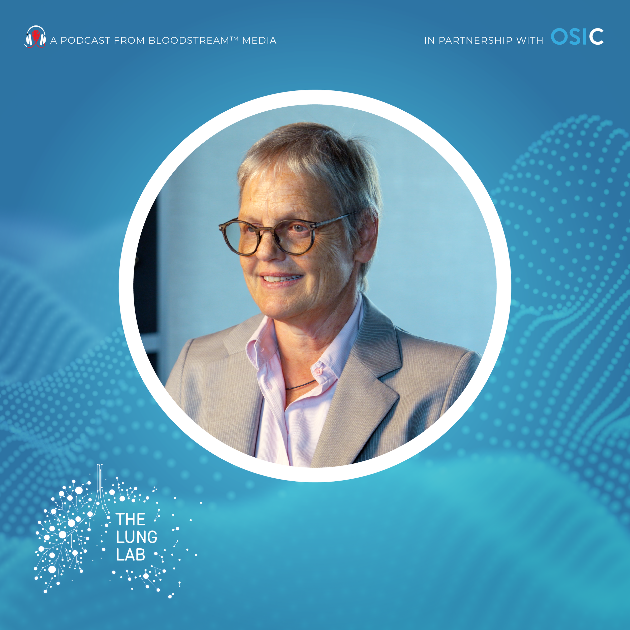 The Future of Bronchiectasis: AI, Machine Learning, and Lessons from IPF