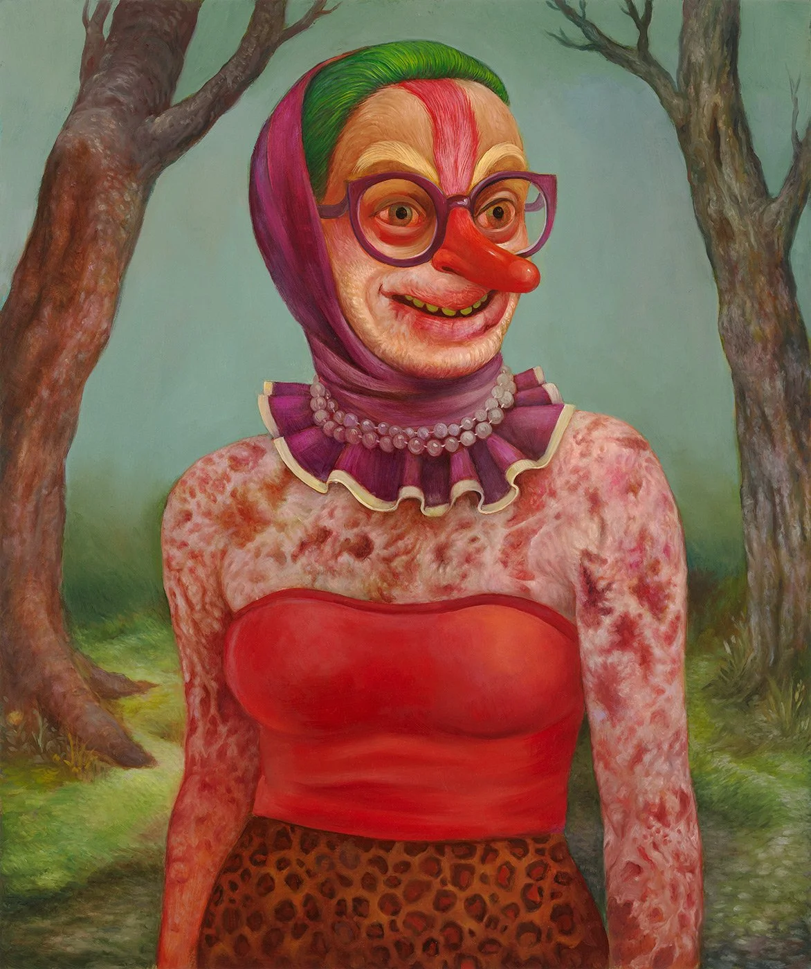 Eczema Scarecrow