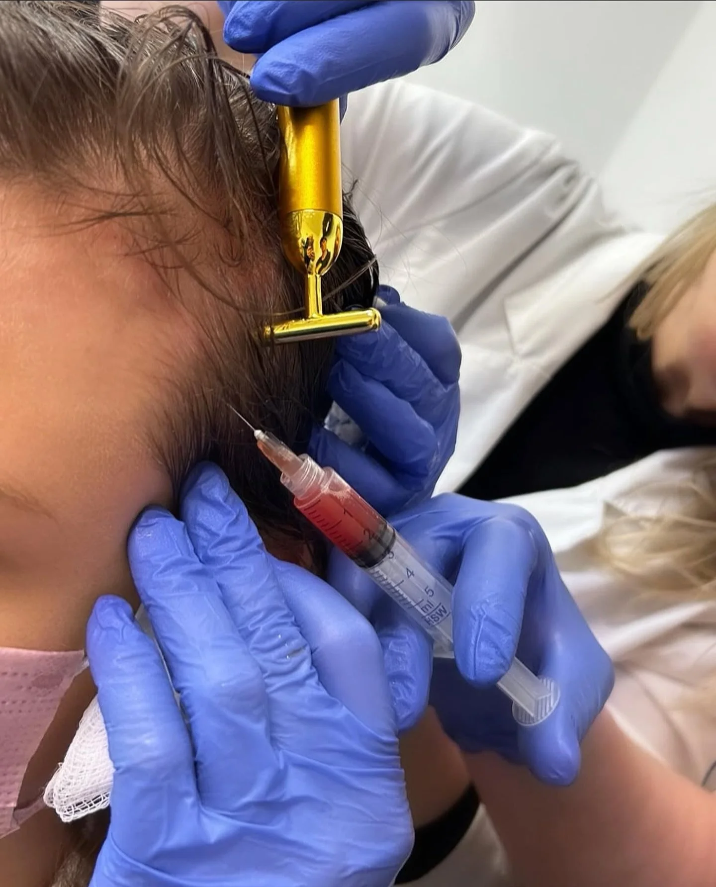 Revitalize your hair, restore your confidence. Say goodbye to thinning hair and hello to a fuller, healthier you with our PRP hair treatment. 

Call or text us at (847) 990-0510 to schedule a free consultation! 💖