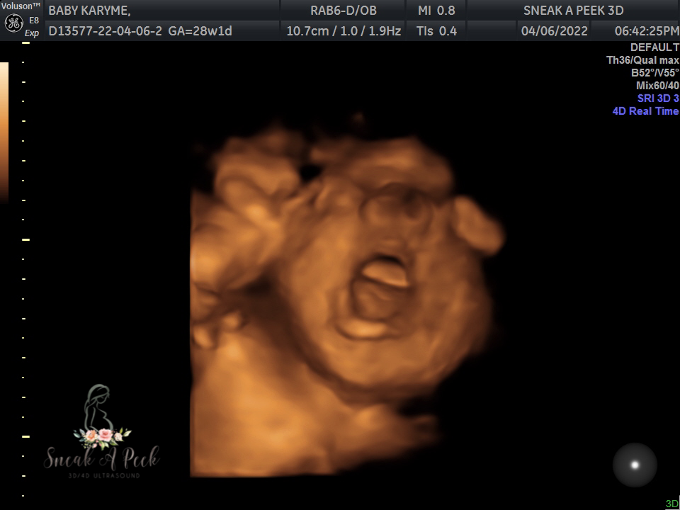 199F8B38-9BFD-4DBB-A070-39E1B07EB6D6.png