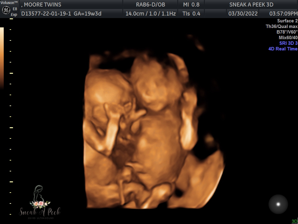 EFECE840-A962-4723-9D2C-7192E7F013BE.png