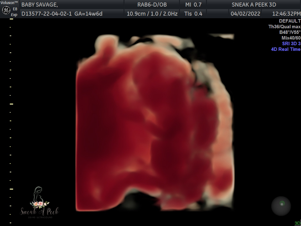 AE99A6C1-1EC9-4033-8E09-CBDD165DA50B.png