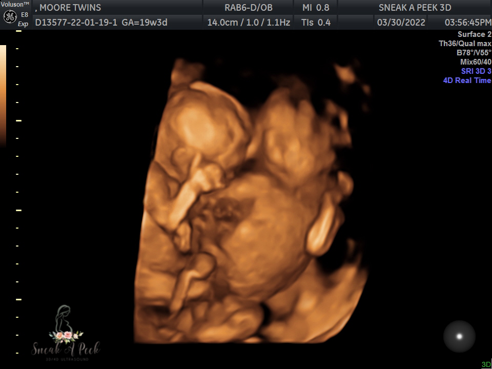 D9C510FF-8A70-49A9-B631-D0844F96B3F0.png