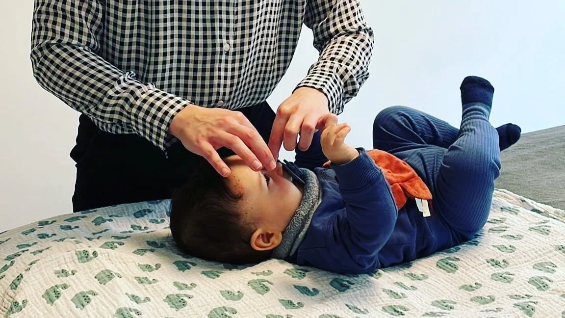 Een schedelafplatting of plagiocephalie bij baby’s