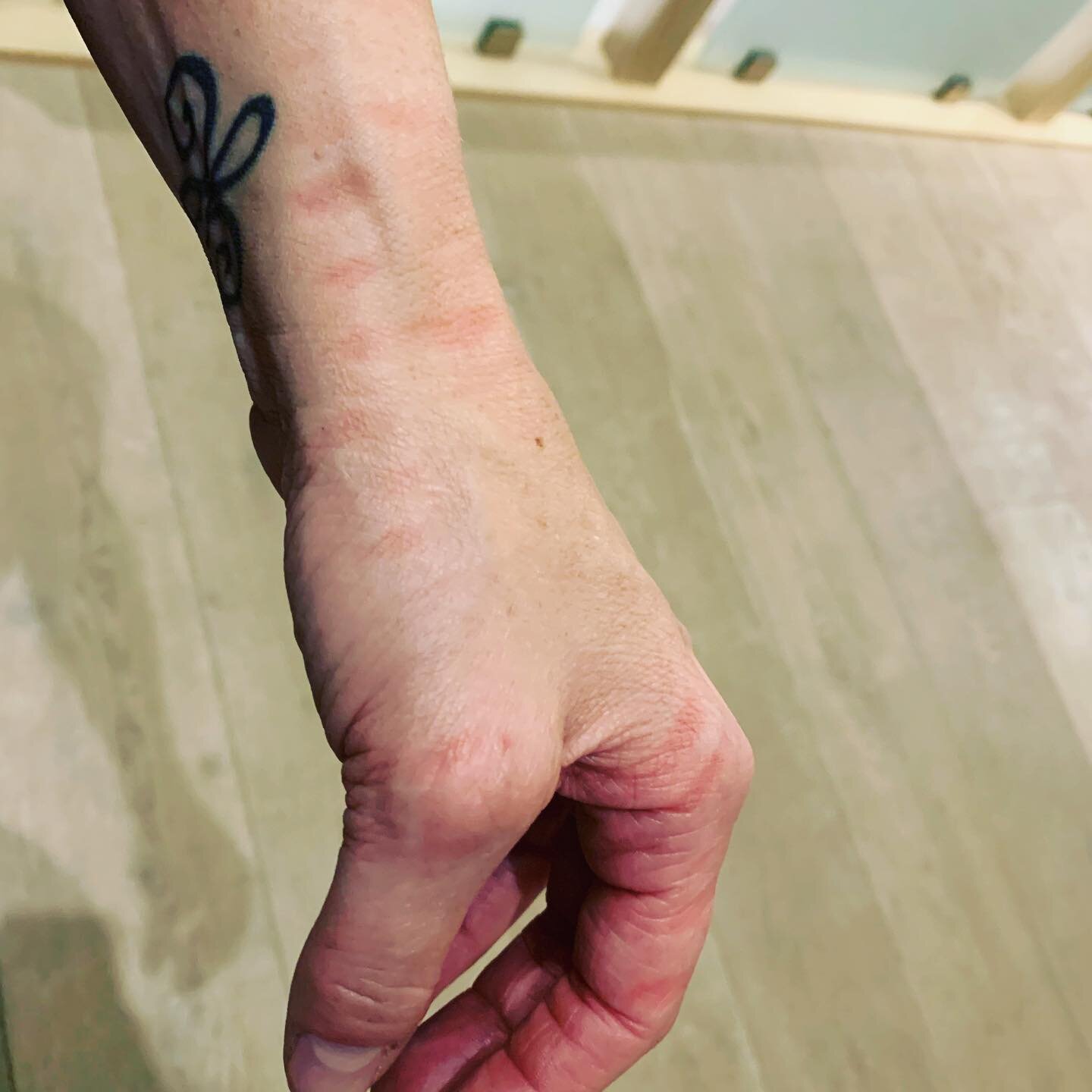 5 minutes of PEMF&hellip;. This shows that this hand had inflammation&hellip;. The cells are now oxygenated and blood is now flowing through her hand&hellip;. Healing ❤️&zwj;🩹 itself. #pemf #ultimatewellness #healyourself #naturalsupplement #ultimat