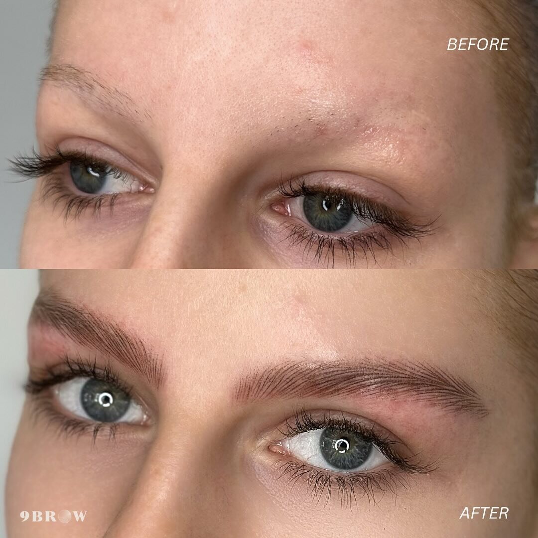 Meet our amazing client who faced alopecia, wanting to restore her original brows before losing her hair. 

We recreated her beloved brows, following her guidance and memories. They may not be perfectly even, but they reflect her unique shape and cha