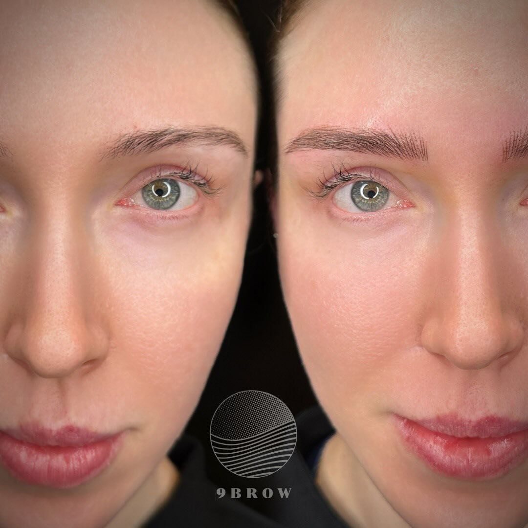 Tired of filling in those patchy spots every day? 😮&zwj;💨

Nanobrows treatment fills in the gaps with natural-looking strokes that blend seamlessly with your existing brows💗

Enjoy full, beautiful brows that last. No more daily pencils needed! 🌿
