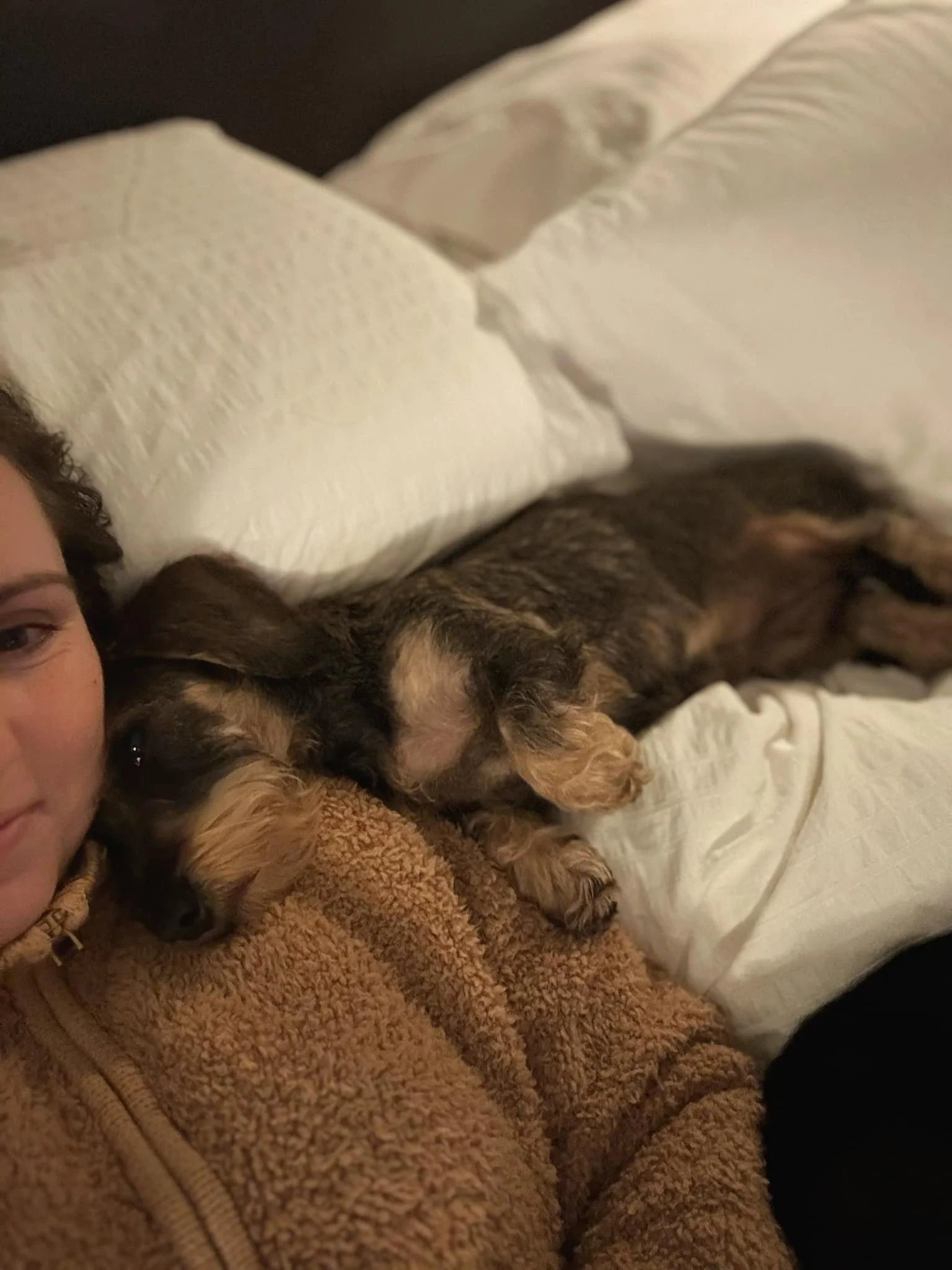 A person lying on a bed with a small, long-haired dog resting its head on their shoulder. The dog is dark brown with lighter patches and is lying on its side on white bedding.