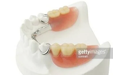 Partial+Dentures,+metal,+metal-free.jpeg