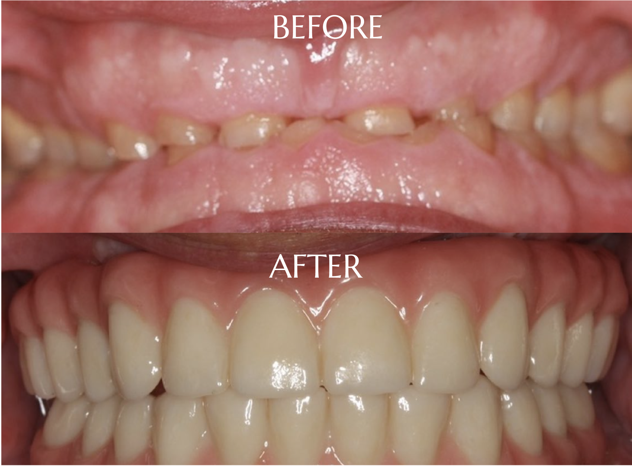 Cosmetic Dentistry Amarillo Dr. Trey Miller, LVIF