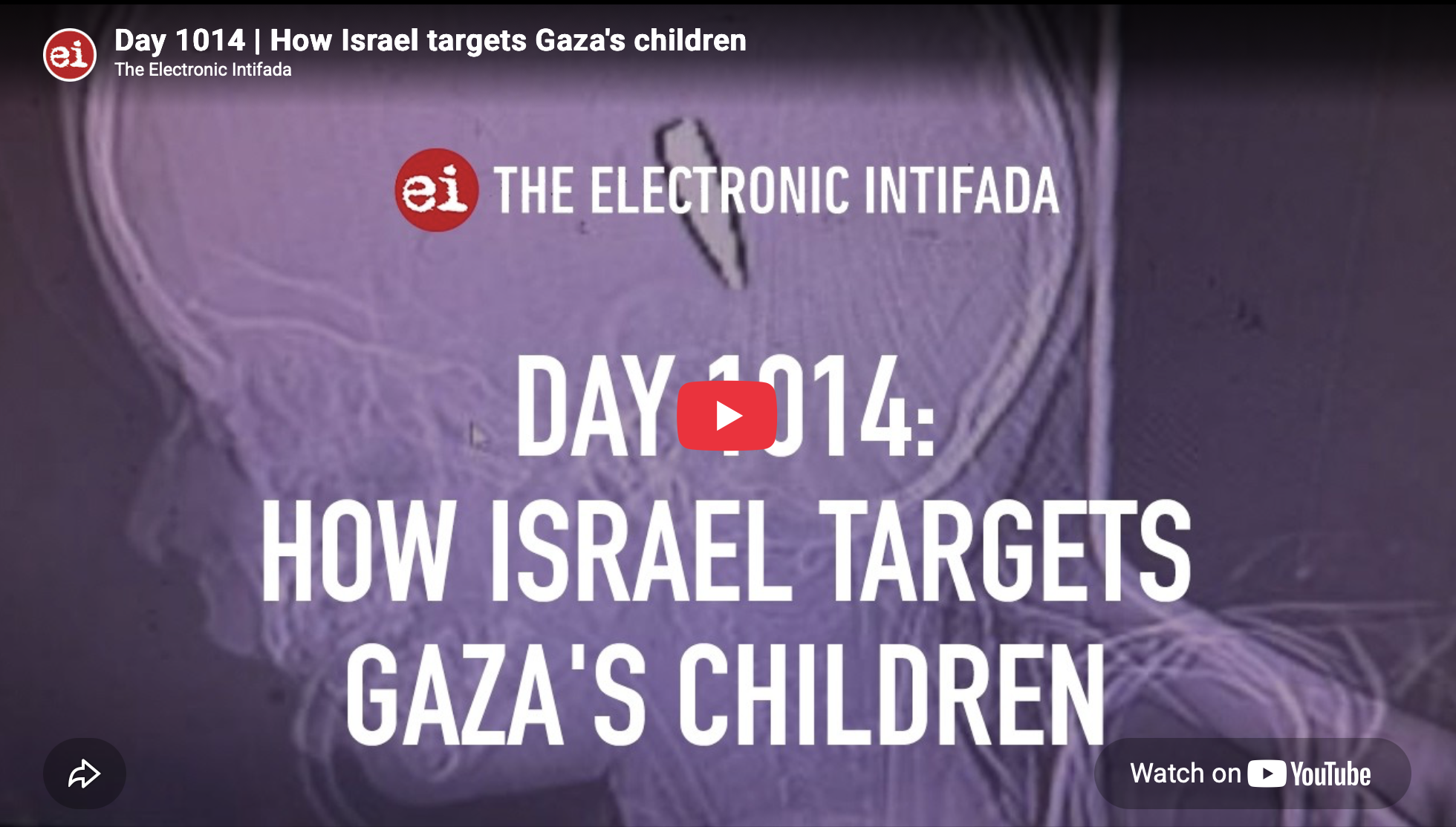 How Israel targets Gaza’s children | Electronic Intifada