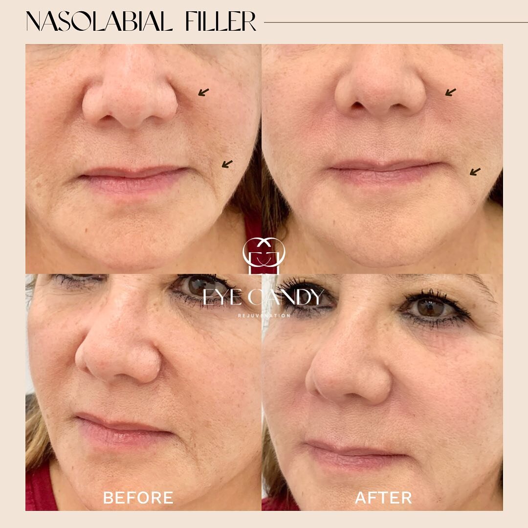 Eye Candy Lash & Brow Bar Buena Park, Newport Beach & Lakewood