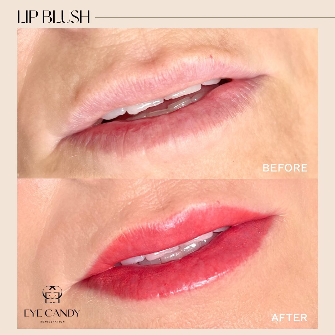 Your lips but Better 👄

Imagine waking up and not having to worry about having pale lips!!!💗👄

*Work done by our talented artist Andrea.

📌 Lip Blushing is discounted right now for only $249 | Available in Buena Park &amp; Newport Beach 🤯

Conta